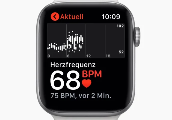 Hervorragend: Herzspezialist lobt die EKG-Funktion der Apple Watch