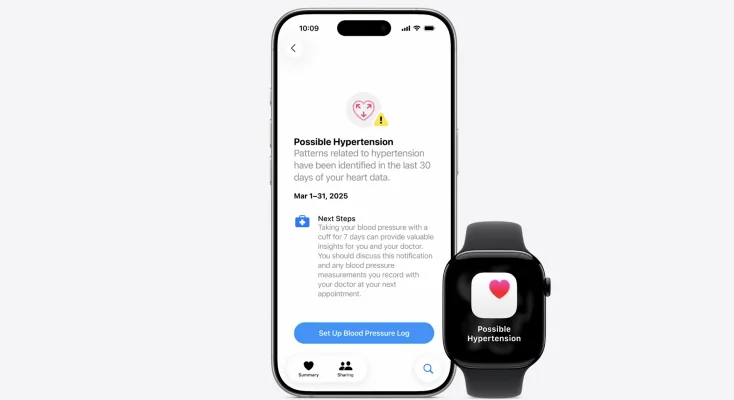 Die Apple Watch Series 11 mit 5G & Erkennung von Bluthochdruck ist da!