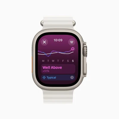 Mit watchOS 11 entfernt Apple das Siri Zifferblatt – intelligenterer Smart-Stapel als Alternative