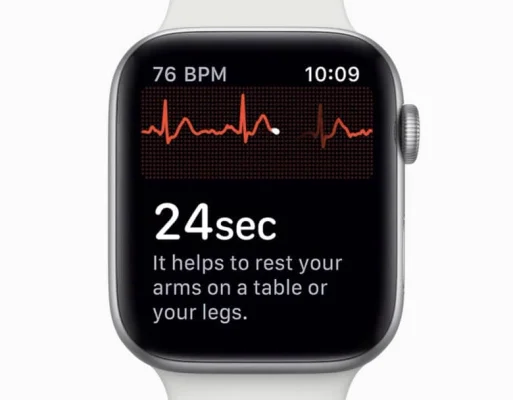 Hervorragend: Herzspezialist lobt die EKG-Funktion der Apple Watch