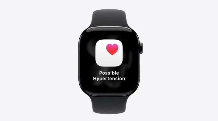 Apple Watch Series 11, SE 3 & Ultra 3: 5G gibt es nicht überall!