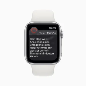 Apple Watch - EKG-Funktion und Mitteilungen bei unregelmäßigem Herzrhythmus ab sofort in Deutschland