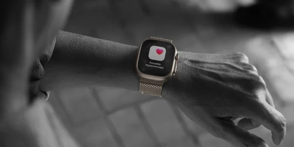 iOS 26.1 bringt Unterstützung für Smartwatches von Drittanbietern mit