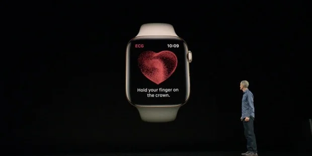 Hervorragend: Herzspezialist lobt die EKG-Funktion der Apple Watch